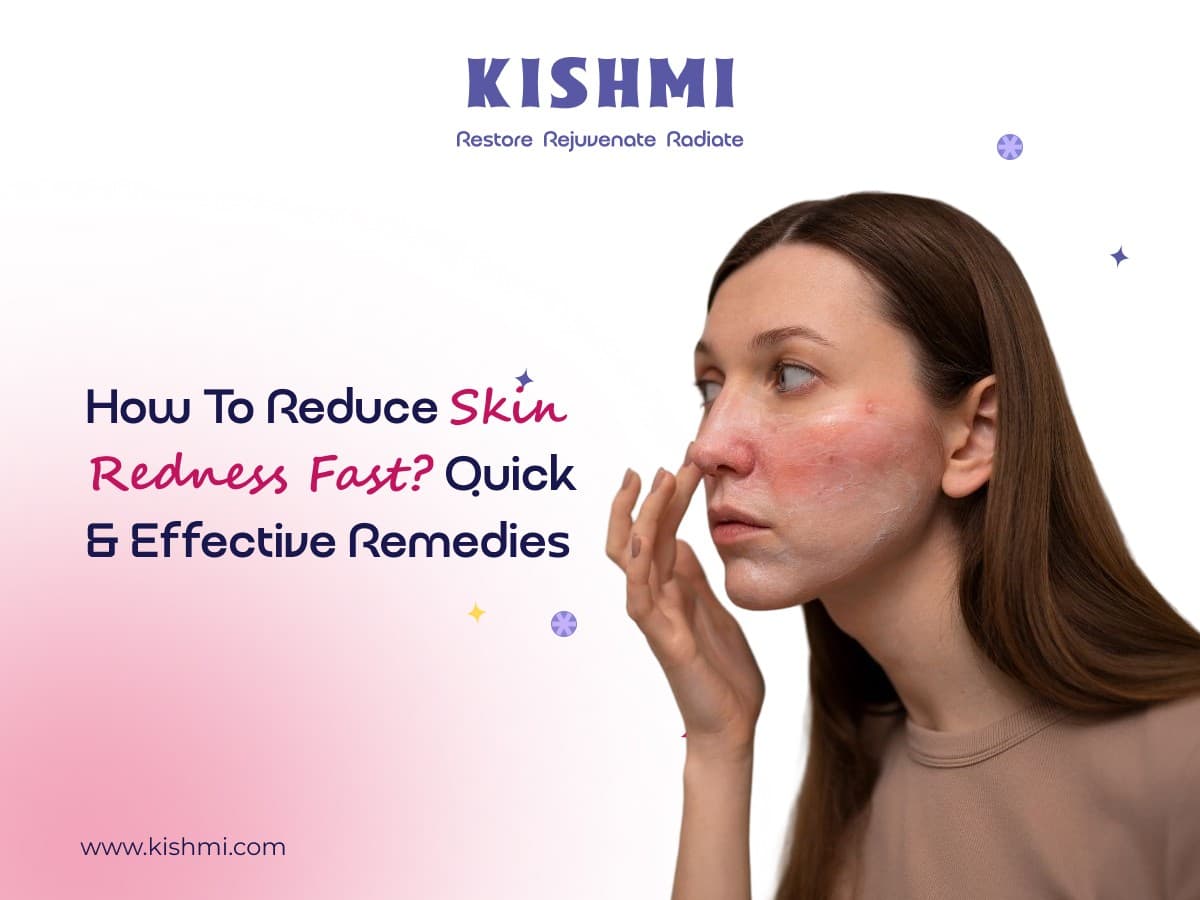 How to Reduce Skin Redness Fast? — image 1