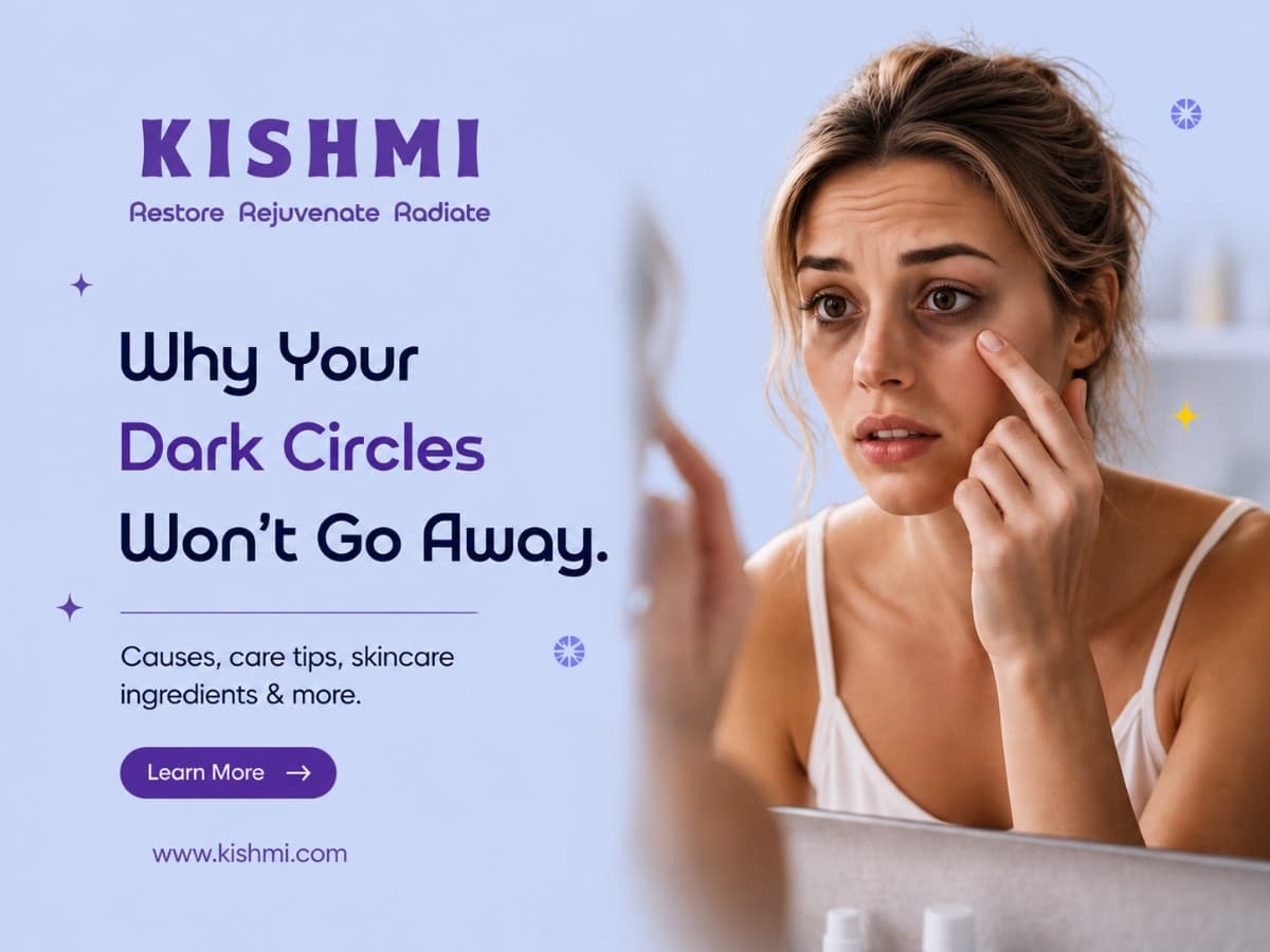 Why Your Dark Circles Won't Go Away — image 1